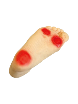  ADVANCED DIABETIC FOOT NURSING MODEL 